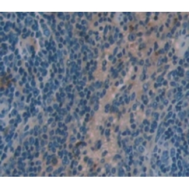 Hemopoietic Cell Kinase (HCK) Mouse Polyclonal Antibody