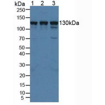 Huntingtin Interacting Protein 1 Related Protein (HIP1R) Human Polyclonal Antibody