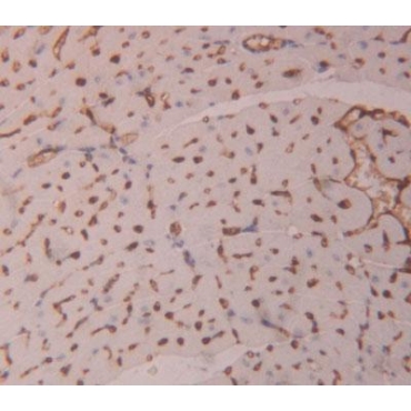 Homeodomain Interacting Protein Kinase 1 (HIPK1) Human Polyclonal Antibody