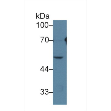 Histidine Rich Glycoprotein (HRG) Human Polyclonal Antibody