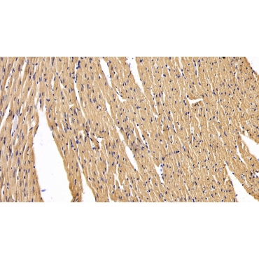 Islet Cell Autoantigen 1 (ICA1) Human Polyclonal Antibody