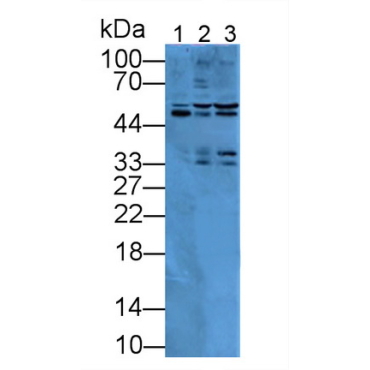 Islet Cell Autoantigen 1 (ICA1) Mouse Polyclonal Antibody