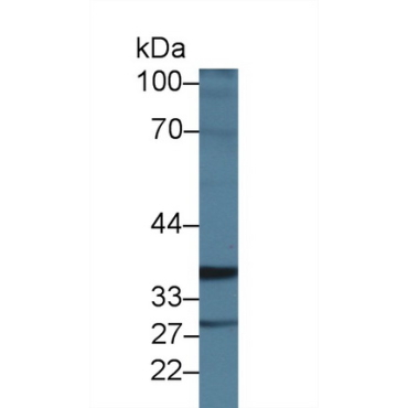 Intestinal Cell Kinase (ICK) Human Polyclonal Antibody