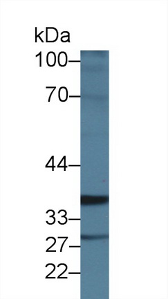 Intestinal Cell Kinase (ICK) Human Polyclonal Antibody