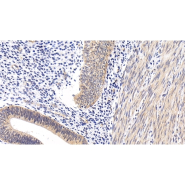 Insulin Receptor Substrate 1 (IRS1) Human Polyclonal Antibody