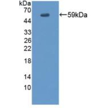 Envoplakin (EVPL) Human Polyclonal Antibody