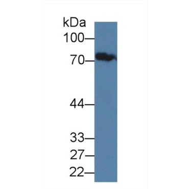 Junctophilin 1 (JPH1) Human Polyclonal Antibody