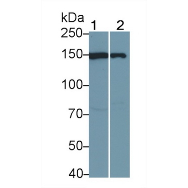 Janus Kinase 1 (JAK1) Human Polyclonal Antibody