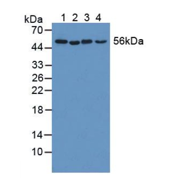 Katanin P60 Subunit A 1 (KATNA1) Human Polyclonal Antibody