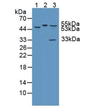 Katanin P60 Subunit A 1 (KATNA1) Mouse Polyclonal Antibody