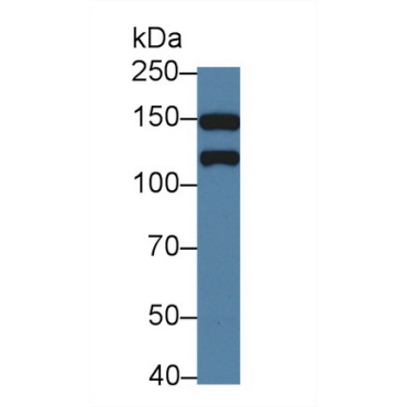 Kinectin 1 (KTN1) Human Polyclonal Antibody