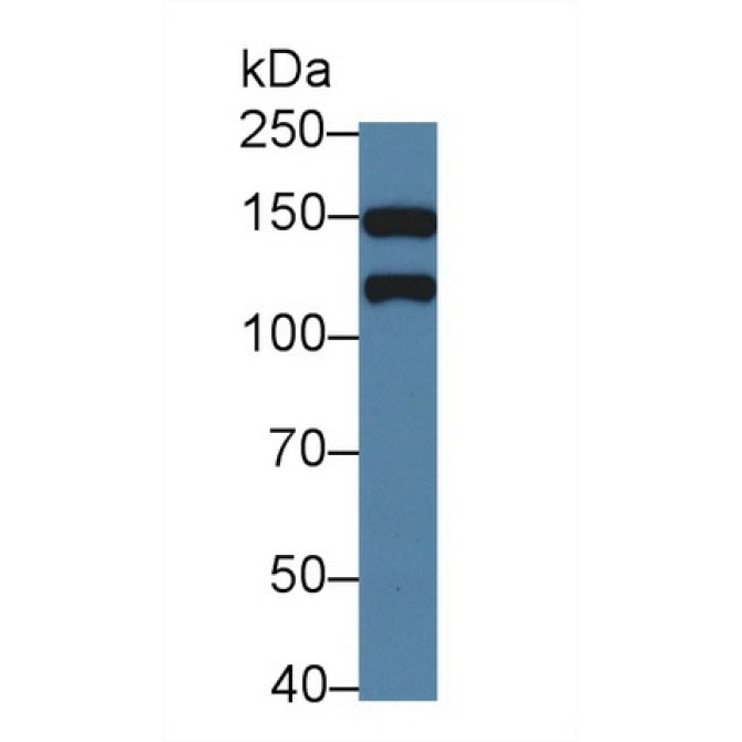 Kinectin 1 (KTN1) Human Polyclonal Antibody