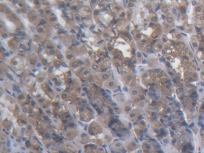 Kinectin 1 (KTN1) Rat Polyclonal Antibody