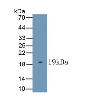 Kisspeptin 1 (KISS1) Human Polyclonal Antibody