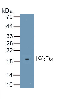 Kisspeptin 1 (KISS1) Human Polyclonal Antibody