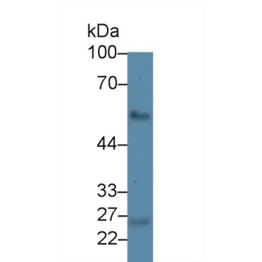 Ladinin 1 (LAD1) Human Polyclonal Antibody