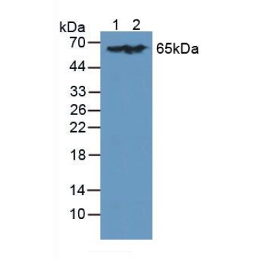 L-Plastin (LCP1) Human Polyclonal Antibody