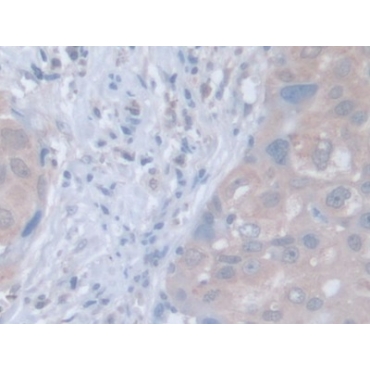 Leucine Zipper, Down Regulated In Cancer 1 (LDOC1) Human Polyclonal Antibody