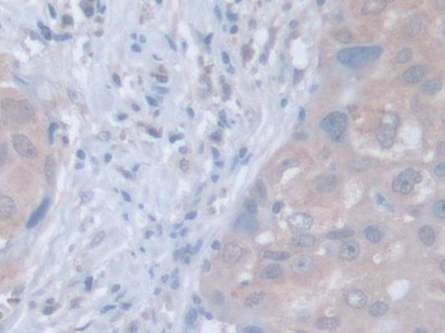 Leucine Zipper, Down Regulated In Cancer 1 (LDOC1) Human Polyclonal Antibody