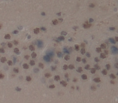 Leucine Zipper, Down Regulated In Cancer 1 (LDOC1) Rat Polyclonal Antibody