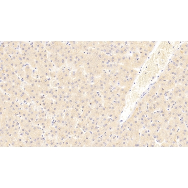 Eukaryotic translation initiation factor 2D (EIF2D) Human Polyclonal Antibody