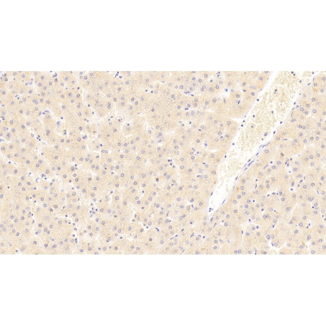 Eukaryotic translation initiation factor 2D (EIF2D) Human Polyclonal Antibody