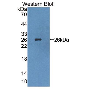 Lens Intrinsic Membrane Protein 2 (LIM2) Human Polyclonal Antibody