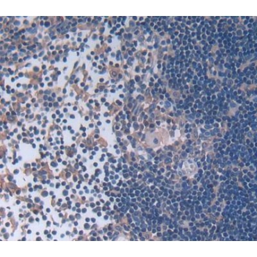 Leupaxin (LPXN) Mouse Polyclonal Antibody