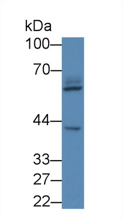 Leucine Rich Repeats And Death Domain Containing Protein (LRDD) Human Polyclonal Antibody