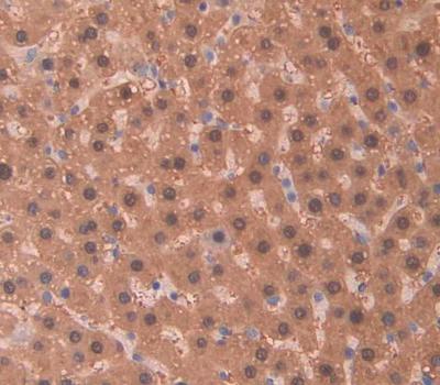 Leucine Rich Repeats And Death Domain Containing Protein (LRDD) Rat Polyclonal Antibody