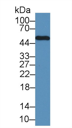 Lymphocyte Specific Protein 1 (LSP1) Mouse Polyclonal Antibody