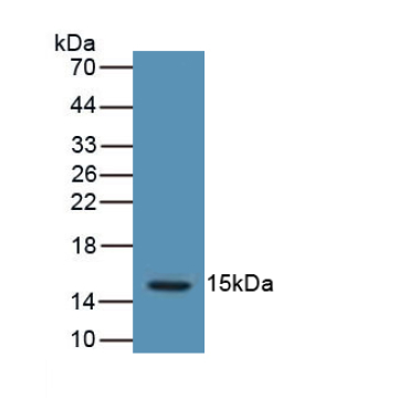 Luteinizing Hormone Beta Polypeptide (LHb) Human Polyclonal Antibody