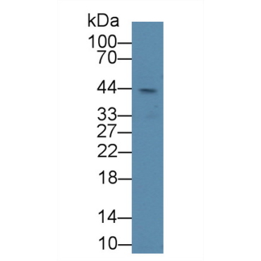 Lysyl Oxidase (LOX) Human Polyclonal Antibody
