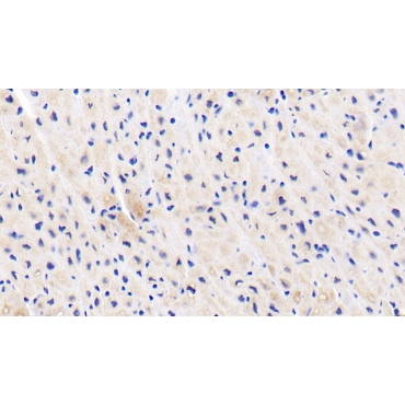 Ubiquitin Associated Protein 1 (UBAP1) Human Polyclonal Antibody