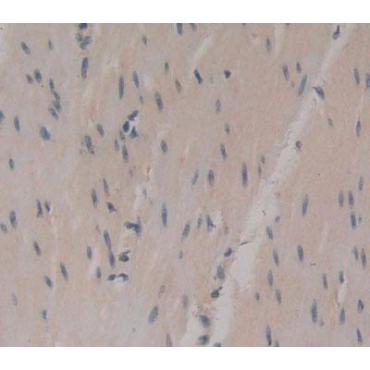 Uridine Cytidine Kinase 2 (UCK2) Human Polyclonal Antibody