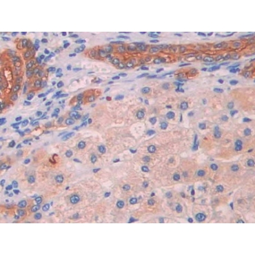Mitochondrial Uncoupling Protein 2 (UCP2) Human Polyclonal Antibody