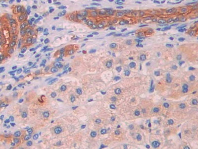 Mitochondrial Uncoupling Protein 2 (UCP2) Human Polyclonal Antibody