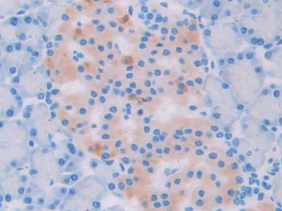Mitochondrial Uncoupling Protein 2 (UCP2) Rat Polyclonal Antibody