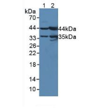 Beta-ureidopropionase (UPB1) Human Polyclonal Antibody
