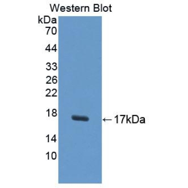 Uroplakin 1A (UPK1A) Human Polyclonal Antibody