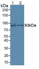 Villin (VIL) Human Polyclonal Antibody