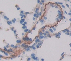 Vasoactive Intestinal Peptide Receptor 1 (VIPR1) Rat Polyclonal Antibody