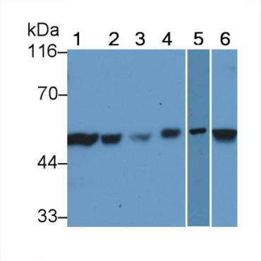 X-linked Inhibitor Of Apoptosis Protein (XIAP) Human Polyclonal Antibody
