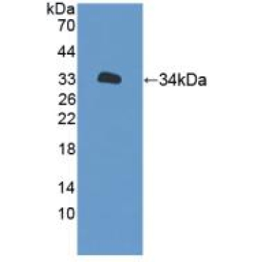 Xylosyltransferase II (XYLT2) Human Polyclonal Antibody