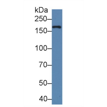 Xanthine Dehydrogenase (XDH) Human Polyclonal Antibody