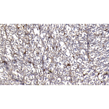 Y-Box Binding Protein 1 (YBX1) Human Polyclonal Antibody