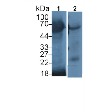 Methyl CpG Binding Protein 2 (MECP2) Human Polyclonal Antibody