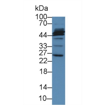 Microfibrillar Associated Protein 2 (MFAP2) Human Polyclonal Antibody