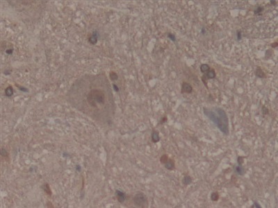 Microfibrillar Associated Protein 2 (MFAP2) Rat Polyclonal Antibody
