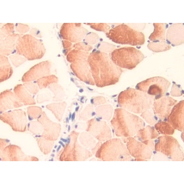 Midline 1 (MID1) Mouse Polyclonal Antibody